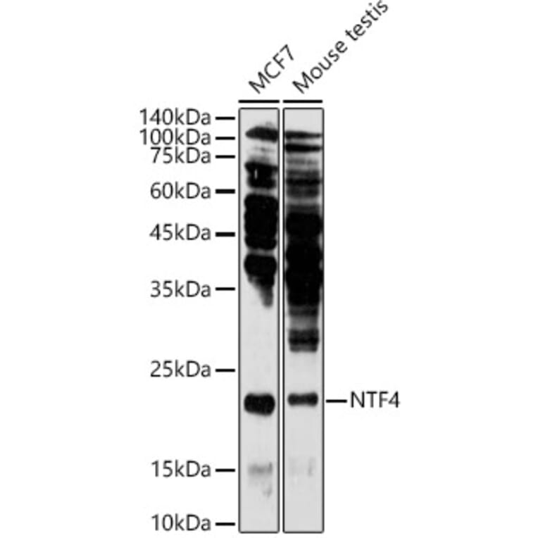 Western Blot - Anti-NT-4 Antibody (A13073) - Antibodies.com