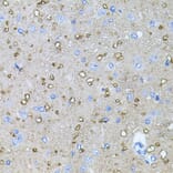 Immunohistochemistry - Anti-NT-4 Antibody (A13073) - Antibodies.com