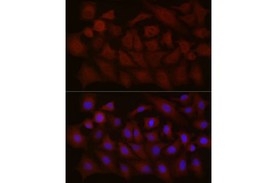 Immunofluorescence - Anti-NT-4 Antibody (A13073) - Antibodies.com