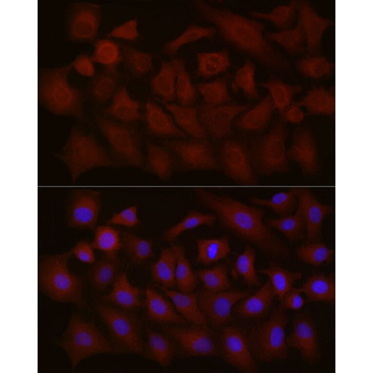 Immunofluorescence - Anti-NT-4 Antibody (A13073) - Antibodies.com
