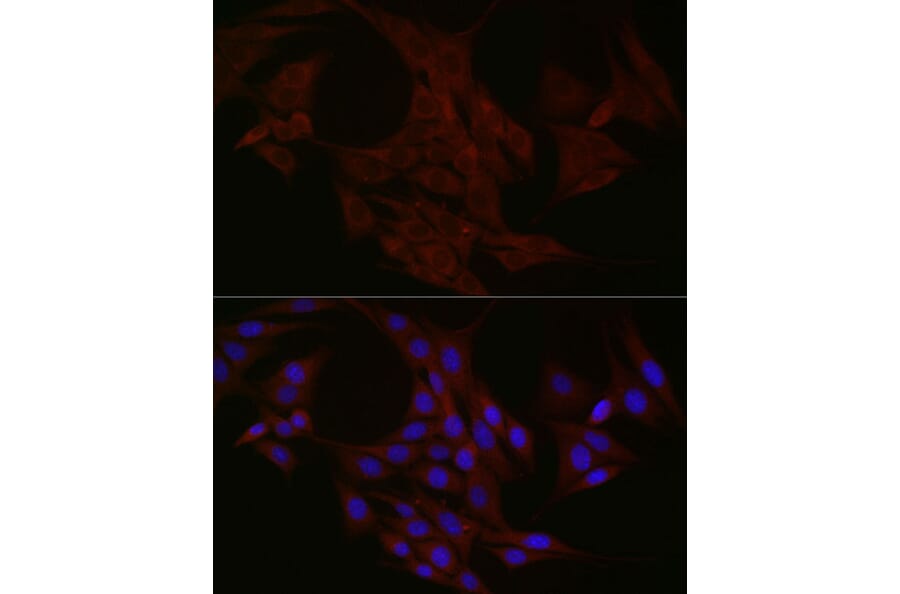 Immunofluorescence - Anti-NT-4 Antibody (A13073) - Antibodies.com