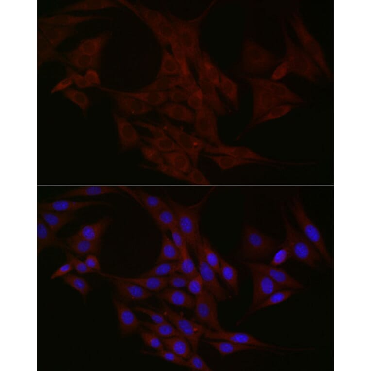 Immunofluorescence - Anti-NT-4 Antibody (A13073) - Antibodies.com