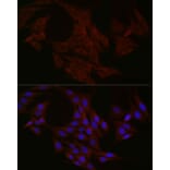Immunofluorescence - Anti-NT-4 Antibody (A13073) - Antibodies.com