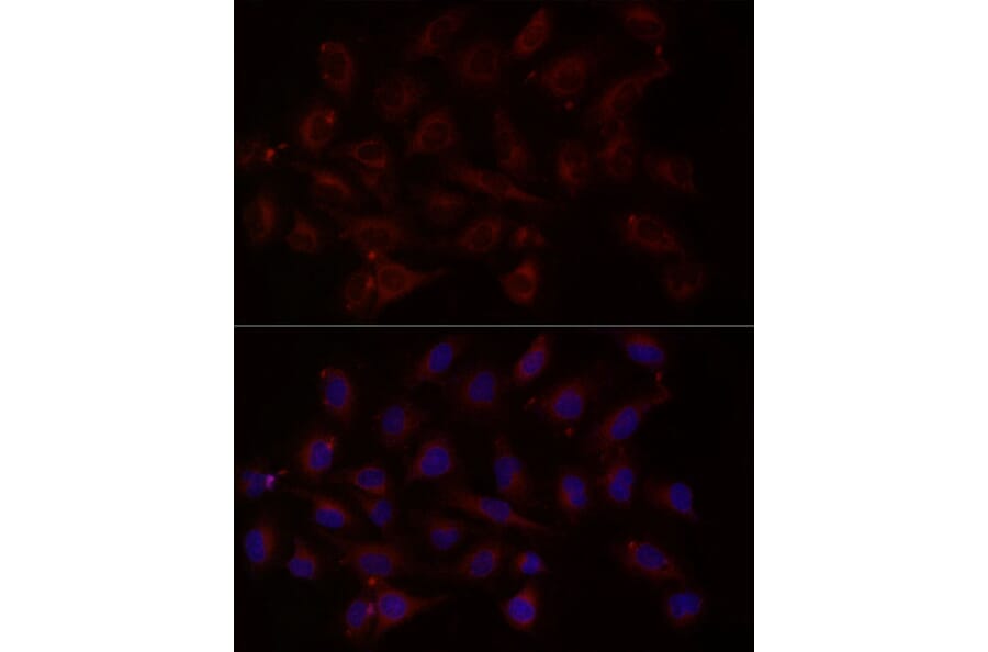 Immunofluorescence - Anti-NT-4 Antibody (A13073) - Antibodies.com