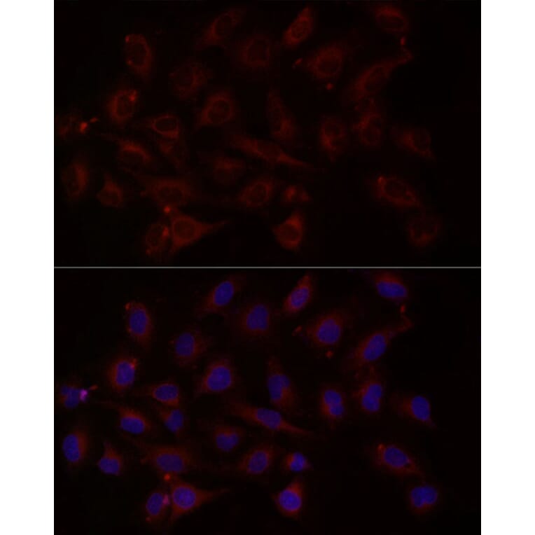 Immunofluorescence - Anti-NT-4 Antibody (A13073) - Antibodies.com