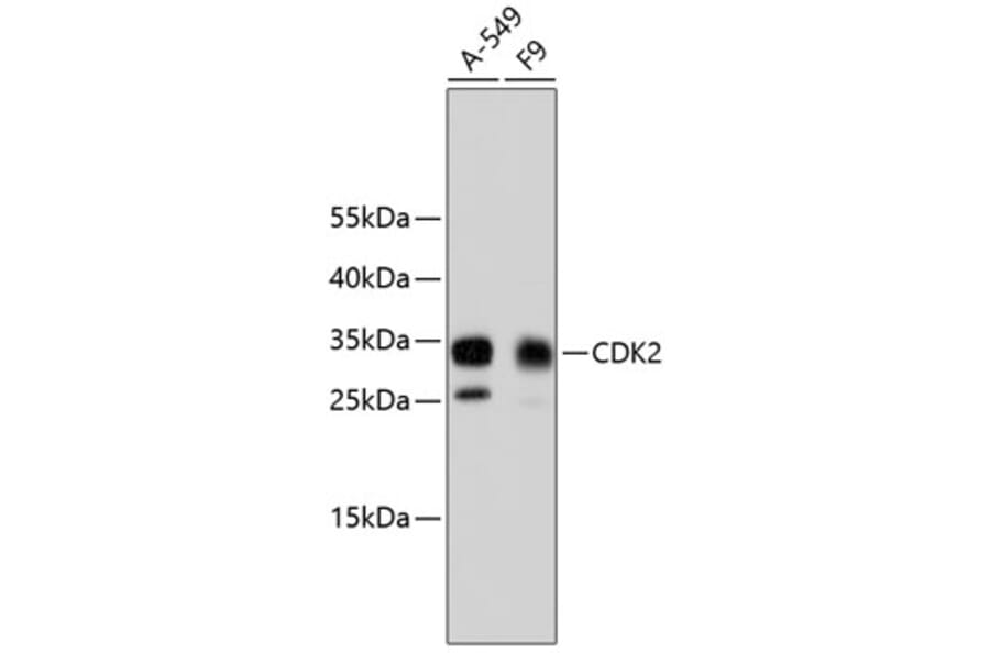 Western Blot - Anti-CDK2 Antibody (A10810) - Antibodies.com
