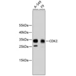 Western Blot - Anti-CDK2 Antibody (A10810) - Antibodies.com