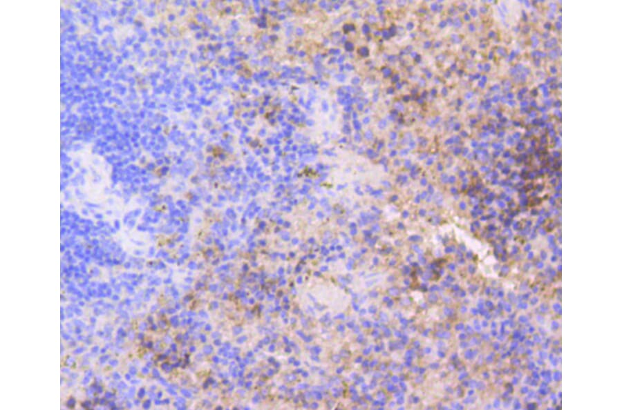 Immunohistochemistry - Anti-CDK2 Antibody (A10810) - Antibodies.com