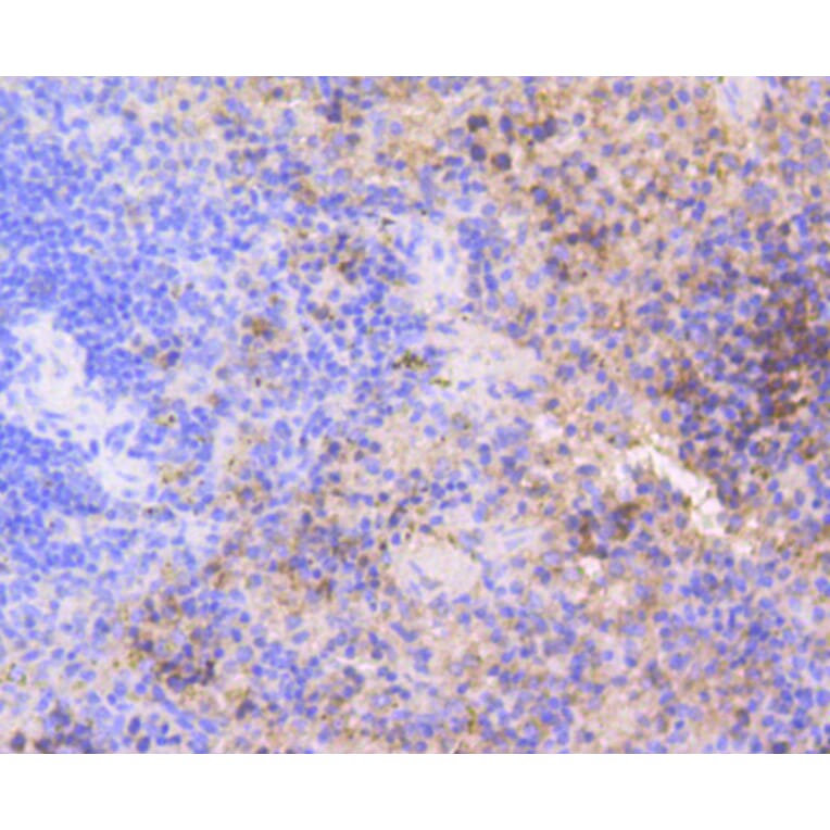 Immunohistochemistry - Anti-CDK2 Antibody (A10810) - Antibodies.com