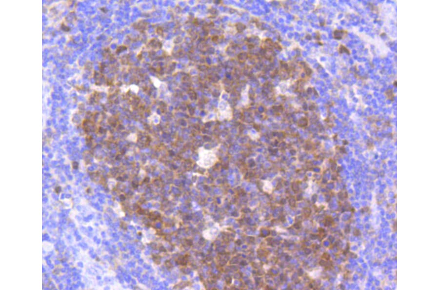 Immunohistochemistry - Anti-CDK2 Antibody (A10810) - Antibodies.com