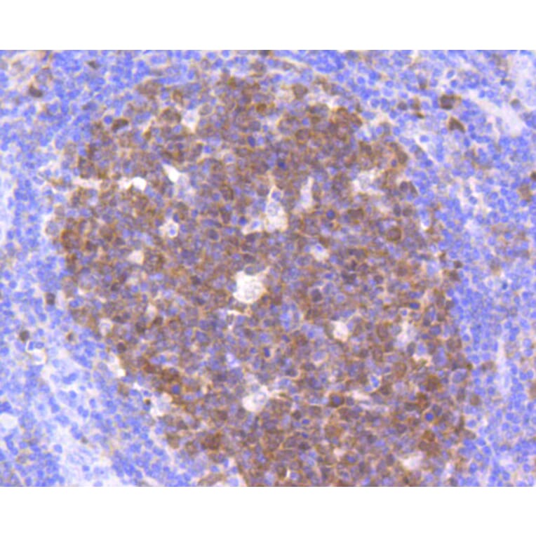 Immunohistochemistry - Anti-CDK2 Antibody (A10810) - Antibodies.com