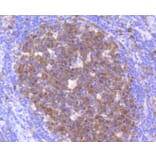 Immunohistochemistry - Anti-CDK2 Antibody (A10810) - Antibodies.com