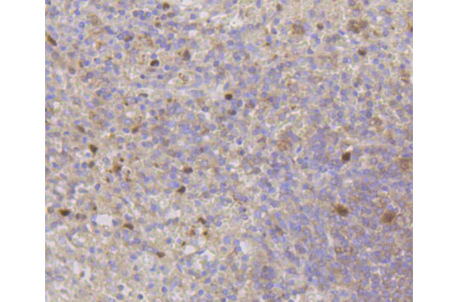 Immunohistochemistry - Anti-CDK2 Antibody (A10810) - Antibodies.com