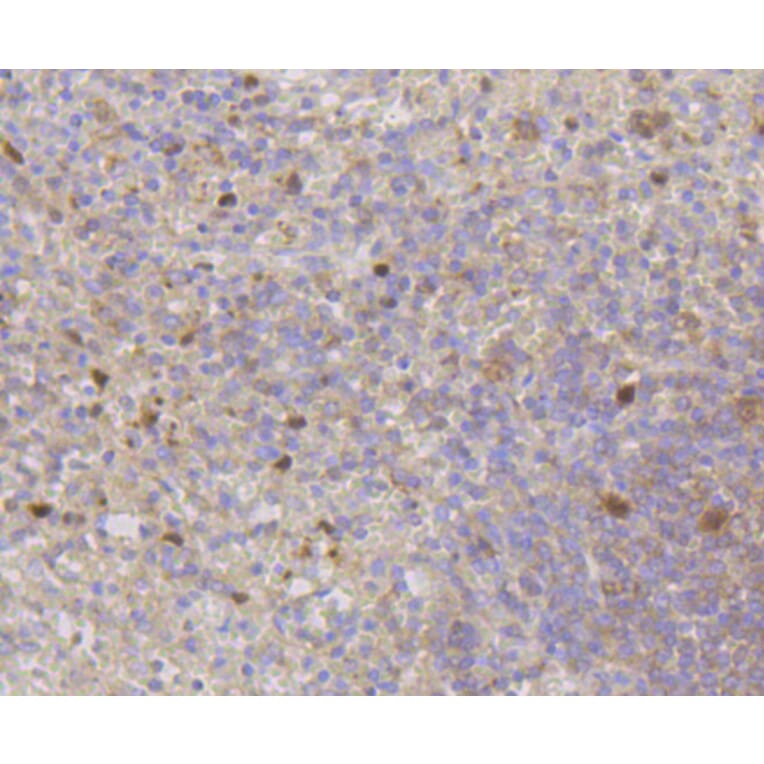 Immunohistochemistry - Anti-CDK2 Antibody (A10810) - Antibodies.com