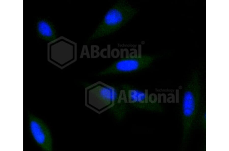 Immunofluorescence - Anti-CDK2 Antibody (A10810) - Antibodies.com