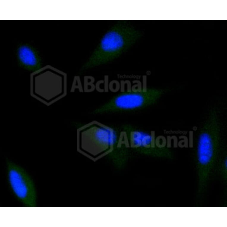 Immunofluorescence - Anti-CDK2 Antibody (A10810) - Antibodies.com