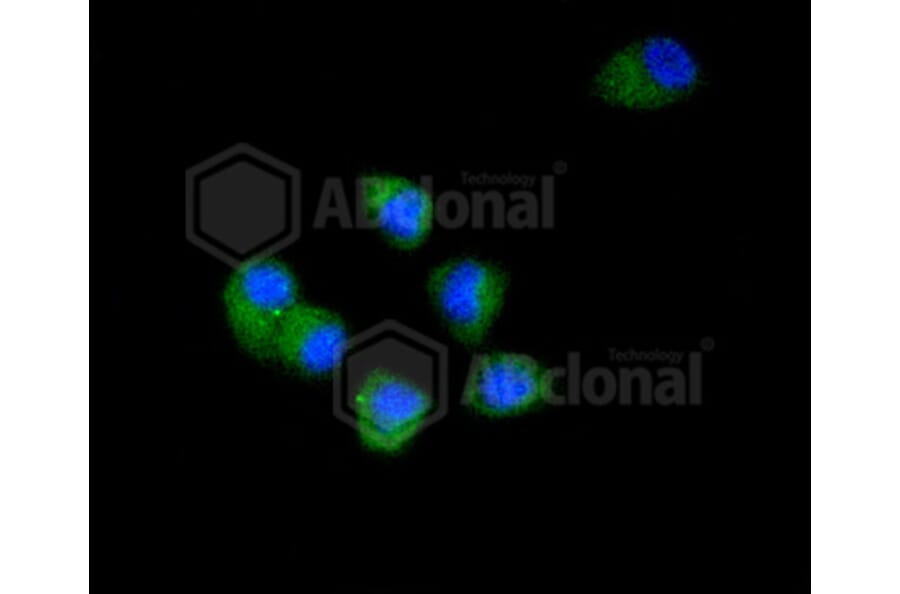 Immunofluorescence - Anti-CDK2 Antibody (A10810) - Antibodies.com