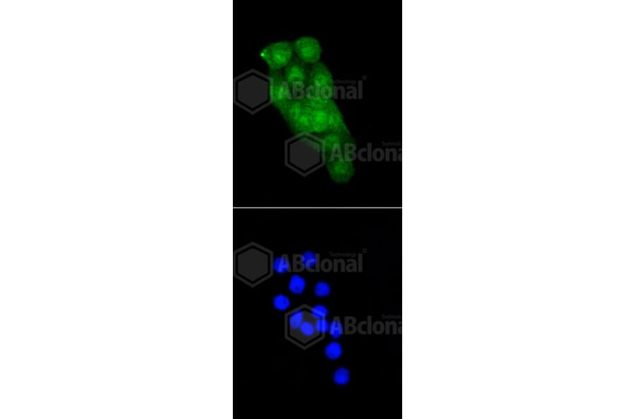 Immunofluorescence - Anti-CDK2 Antibody (A10810) - Antibodies.com