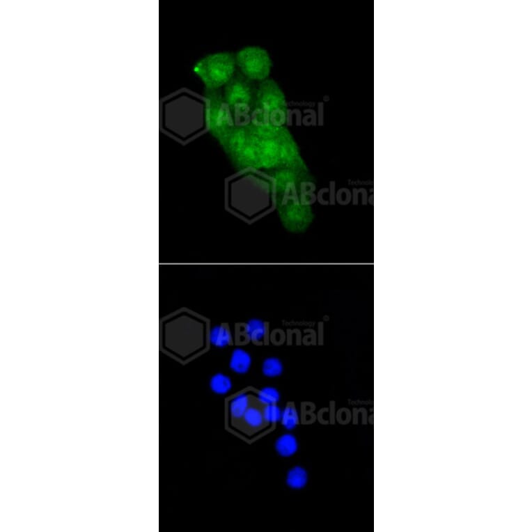 Immunofluorescence - Anti-CDK2 Antibody (A10810) - Antibodies.com