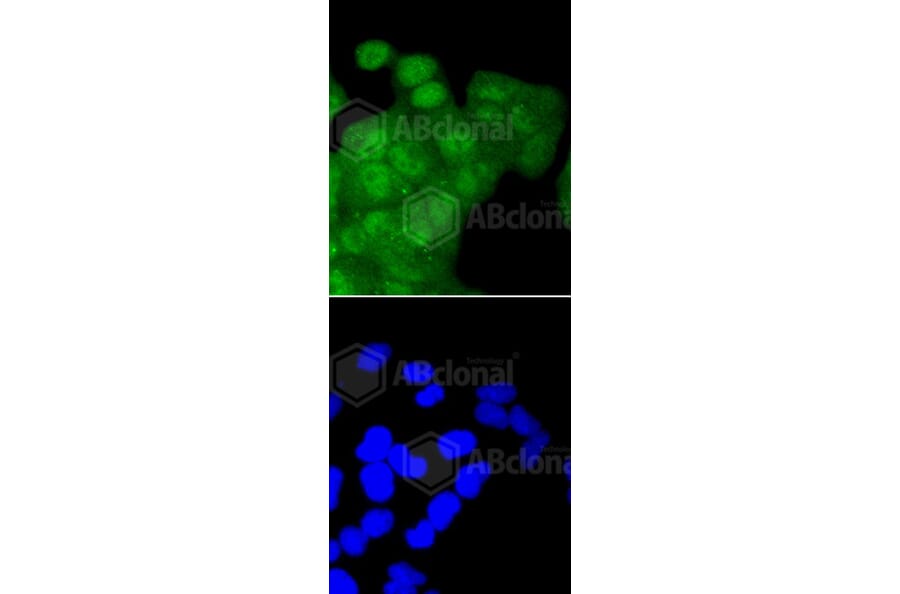 Immunofluorescence - Anti-CDK2 Antibody (A10810) - Antibodies.com