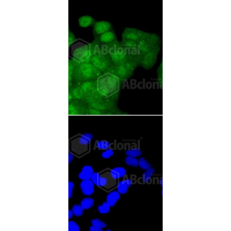 Immunofluorescence - Anti-CDK2 Antibody (A10810) - Antibodies.com