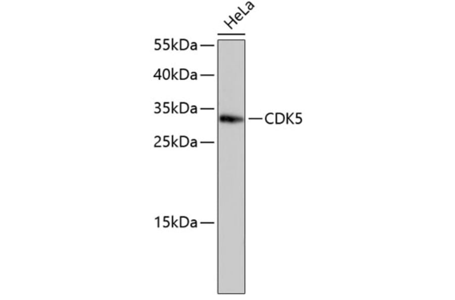 Western Blot - Anti-CDK5 Antibody (A10814) - Antibodies.com