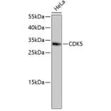 Western Blot - Anti-CDK5 Antibody (A10814) - Antibodies.com