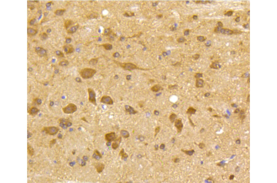 Immunohistochemistry - Anti-CDK5 Antibody (A10814) - Antibodies.com