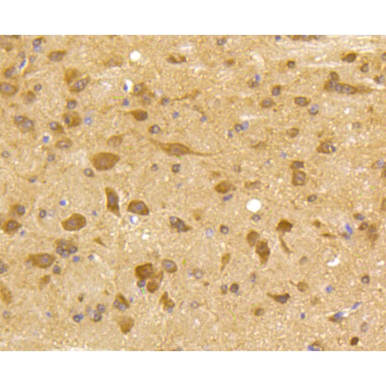 Immunohistochemistry - Anti-CDK5 Antibody (A10814) - Antibodies.com