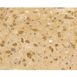 Immunohistochemistry - Anti-CDK5 Antibody (A10814) - Antibodies.com
