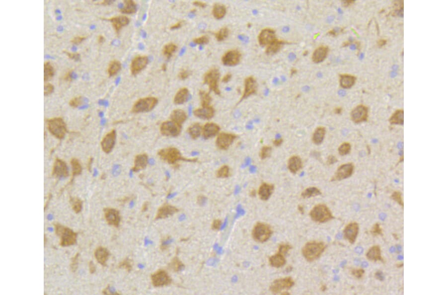 Immunohistochemistry - Anti-CDK5 Antibody (A10814) - Antibodies.com