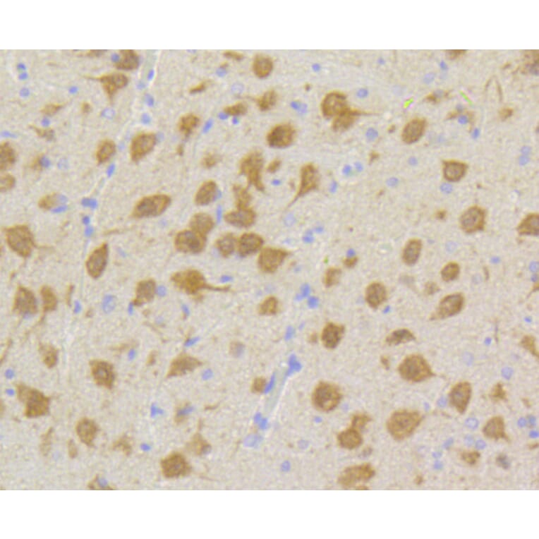 Immunohistochemistry - Anti-CDK5 Antibody (A10814) - Antibodies.com