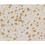 Immunohistochemistry - Anti-CDK5 Antibody (A10814) - Antibodies.com