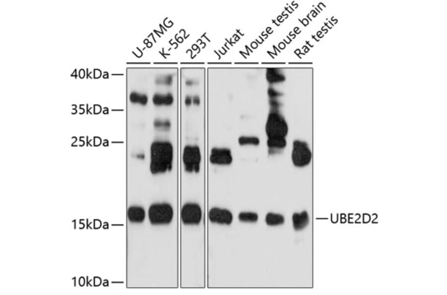 Western Blot - Anti-UBC4 Antibody (A13079) - Antibodies.com