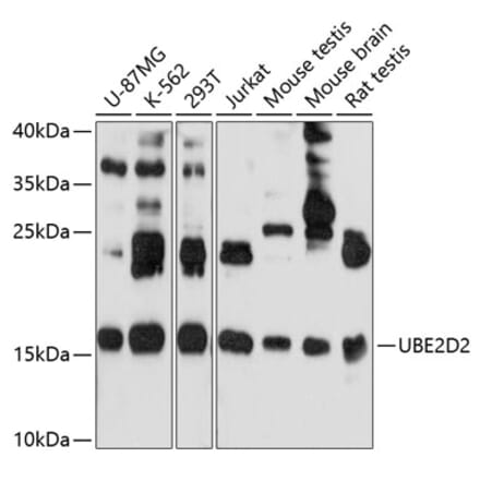 Western Blot - Anti-UBC4 Antibody (A13079) - Antibodies.com