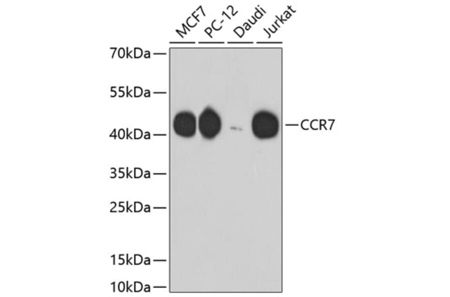 Western Blot - Anti-CCR7 Antibody (A10820) - Antibodies.com
