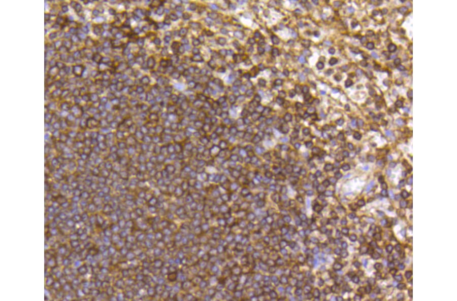 Immunohistochemistry - Anti-CCR7 Antibody (A10820) - Antibodies.com