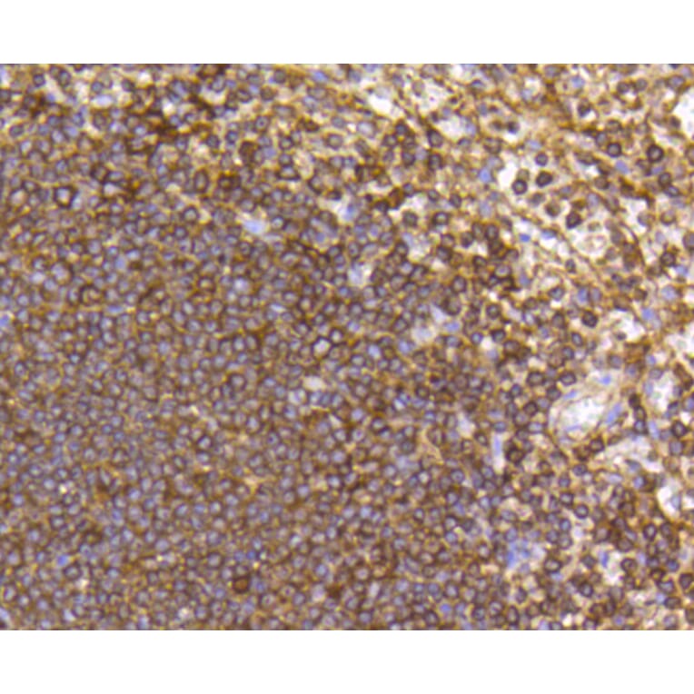 Immunohistochemistry - Anti-CCR7 Antibody (A10820) - Antibodies.com
