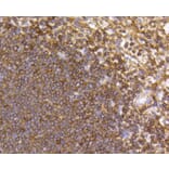Immunohistochemistry - Anti-CCR7 Antibody (A10820) - Antibodies.com
