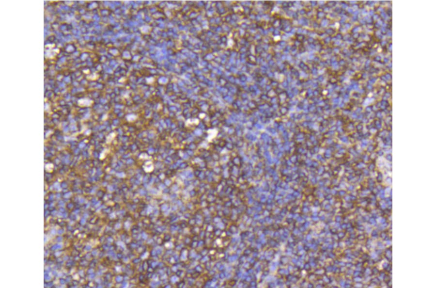 Immunohistochemistry - Anti-CCR7 Antibody (A10820) - Antibodies.com