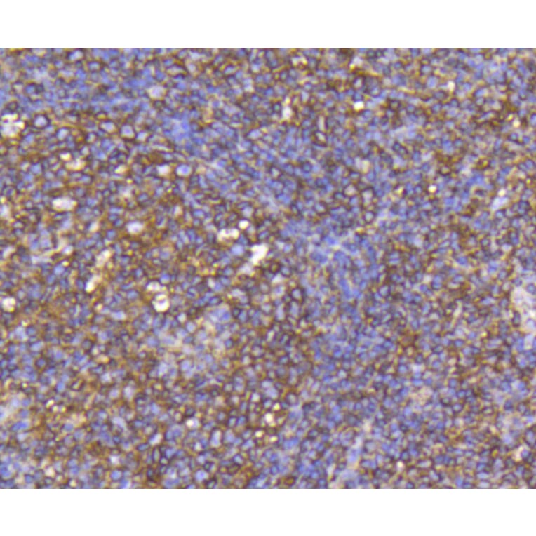 Immunohistochemistry - Anti-CCR7 Antibody (A10820) - Antibodies.com