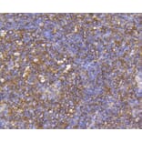 Immunohistochemistry - Anti-CCR7 Antibody (A10820) - Antibodies.com
