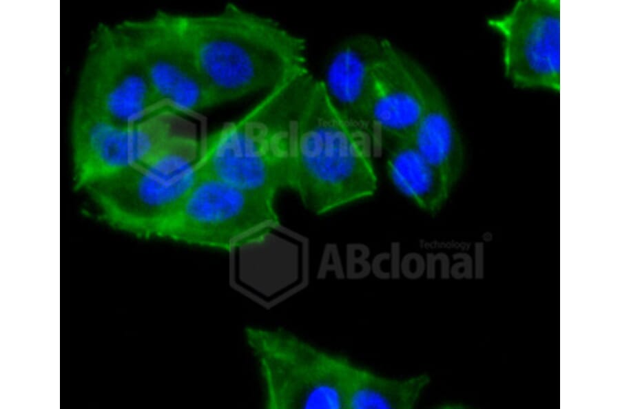 Immunofluorescence - Anti-CCR7 Antibody (A10820) - Antibodies.com