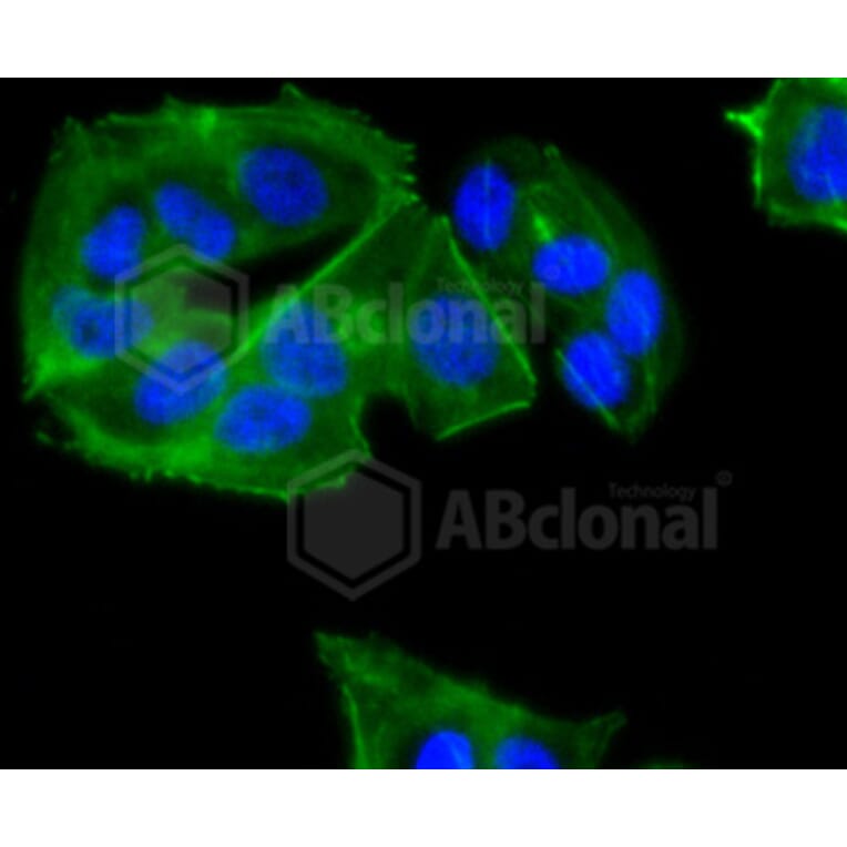 Immunofluorescence - Anti-CCR7 Antibody (A10820) - Antibodies.com