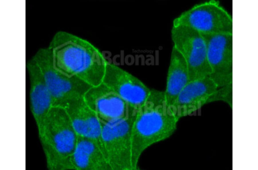 Immunofluorescence - Anti-CCR7 Antibody (A10820) - Antibodies.com
