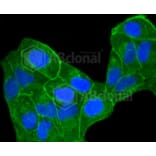 Immunofluorescence - Anti-CCR7 Antibody (A10820) - Antibodies.com
