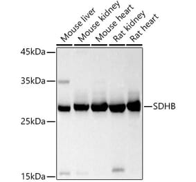 Western Blot - Anti-SDHB Antibody (A13082) - Antibodies.com