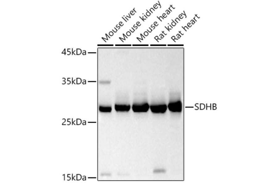 Western Blot - Anti-SDHB Antibody (A13082) - Antibodies.com