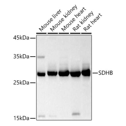 Western Blot - Anti-SDHB Antibody (A13082) - Antibodies.com