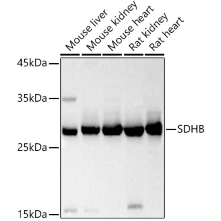 Western Blot - Anti-SDHB Antibody (A13082) - Antibodies.com